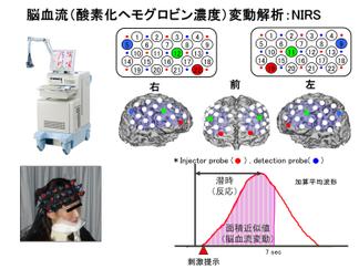 脳血流（酸素化ヘモグロビン濃度）変動解析：NIRS