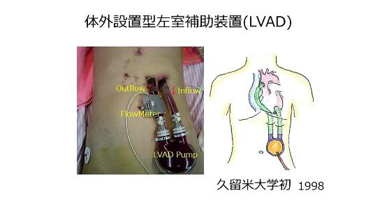 研究者インタビュー】外科学講座（心臓血管外科） 田山 栄基教授 ...