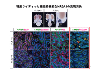 精巣ライディッヒ細胞特異的なNR5A1の発現消失