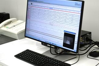 実際に睡眠ポリグラフをしている様子を公開